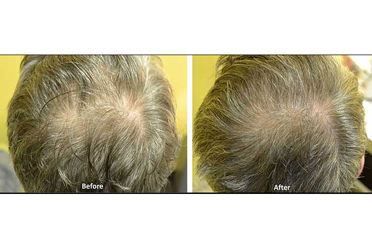 BLOGPOST_RegrowHair07312025_Tw.jpg